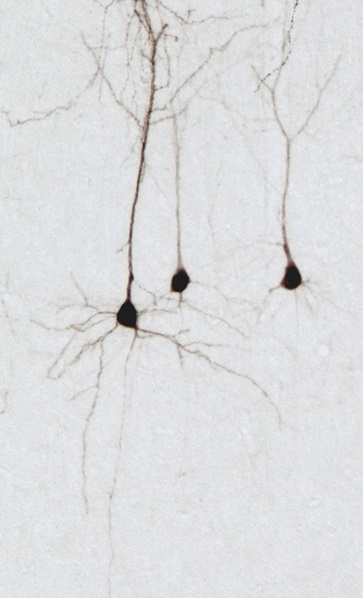 piramidal1